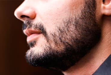 Best Moustache & Beard Hair Reconstruction Clinic in India 